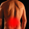 Advancing Sciatica Treatment: Research and Holistic Solutions